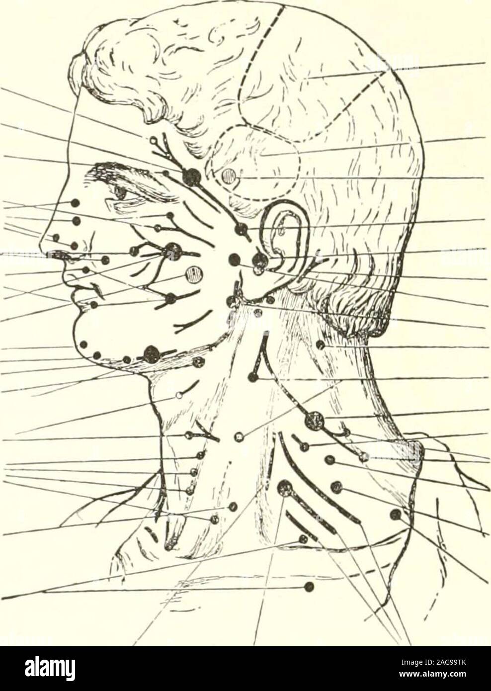 Intercheilion Line . An atlas of the differential diagnosis of the diseases of the nervous ...