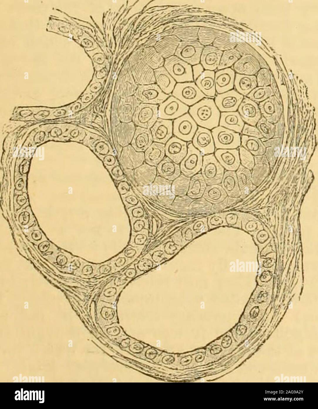 . A Reference handbook of the medical sciences : embracing the entire range of scientific and practical medicine and allied science. with colloid sub-stance similar to thatfound within the vesicles.Wolfler has describedthe gland as consisting ofa cortical portion in whichthe development is incom-plete, the epithelial cellsbeing arranged in solidelongated clusters or col-umns, and a medullaryportion where the glandis fully developed, and allthe cells are arranged toform vesicles. The exist-ence of a limited numberof epithelial columns inthe medullary part of thegland, regarded by Vir-chow as ev Stock Photo
