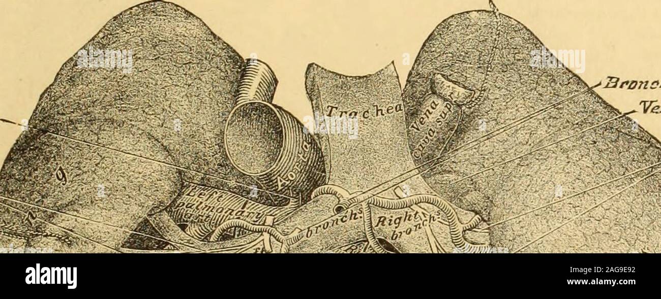 . A Reference handbook of the medical sciences : embracing the entire range of scientific and practical medicine and allied science. luded the su-perior vena cava. In front and externally the superior vena cava is cov-ered by the pleura. The right phrenic nerve lies uponits outer side, and at about one inch and a half from itstermination it enters the pericardium, from which it de-rives a serous covering in front and at the sides, but be-hind it has no covering where it is in contact with theright pulmonary artery and the upper right pulmonaryvein. The relation by its inner side with the ascen Stock Photo