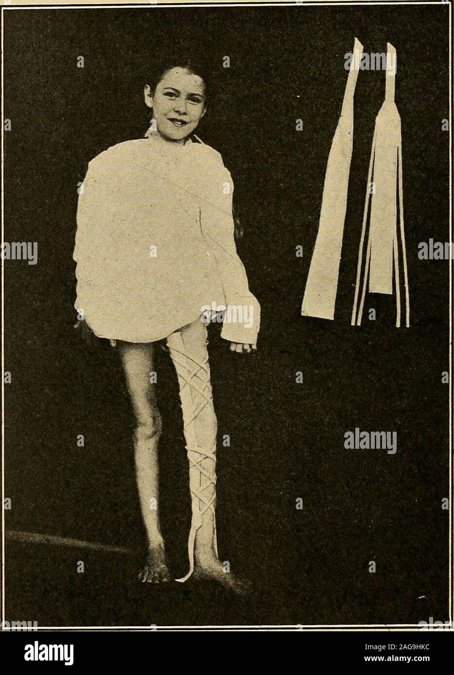 Skin traction hires stock photography and images Alamy