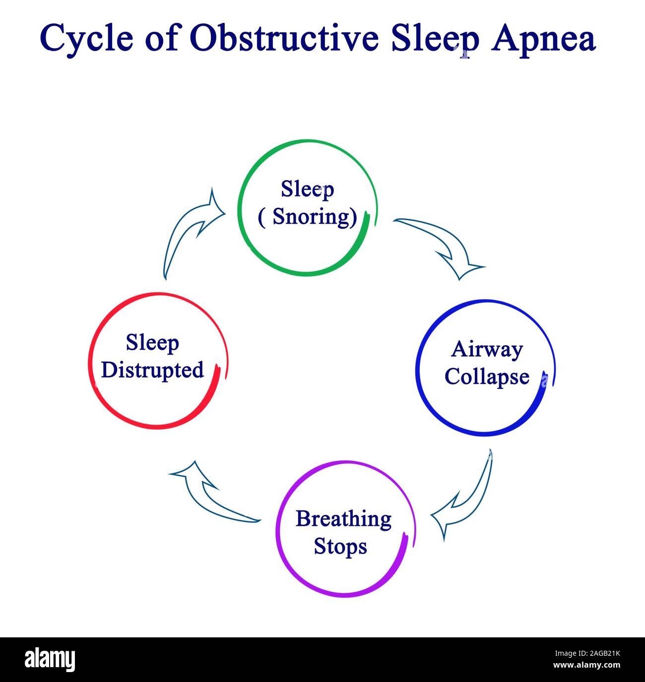 Cycle of Obstructive Sleep Apnea Stock Photo Alamy