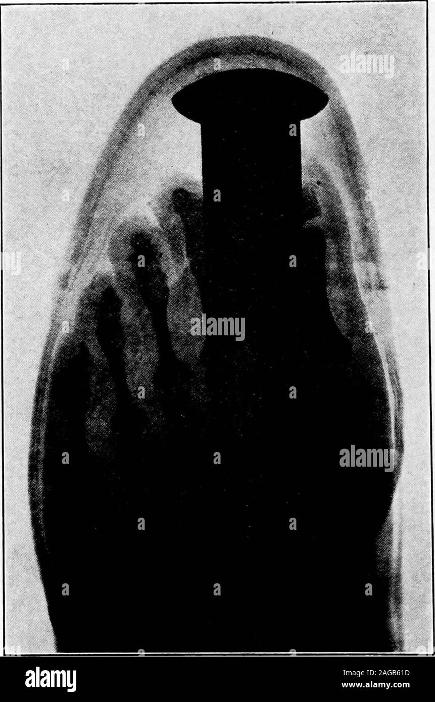 Super imposed Black and White Stock Photos & Images - Alamy