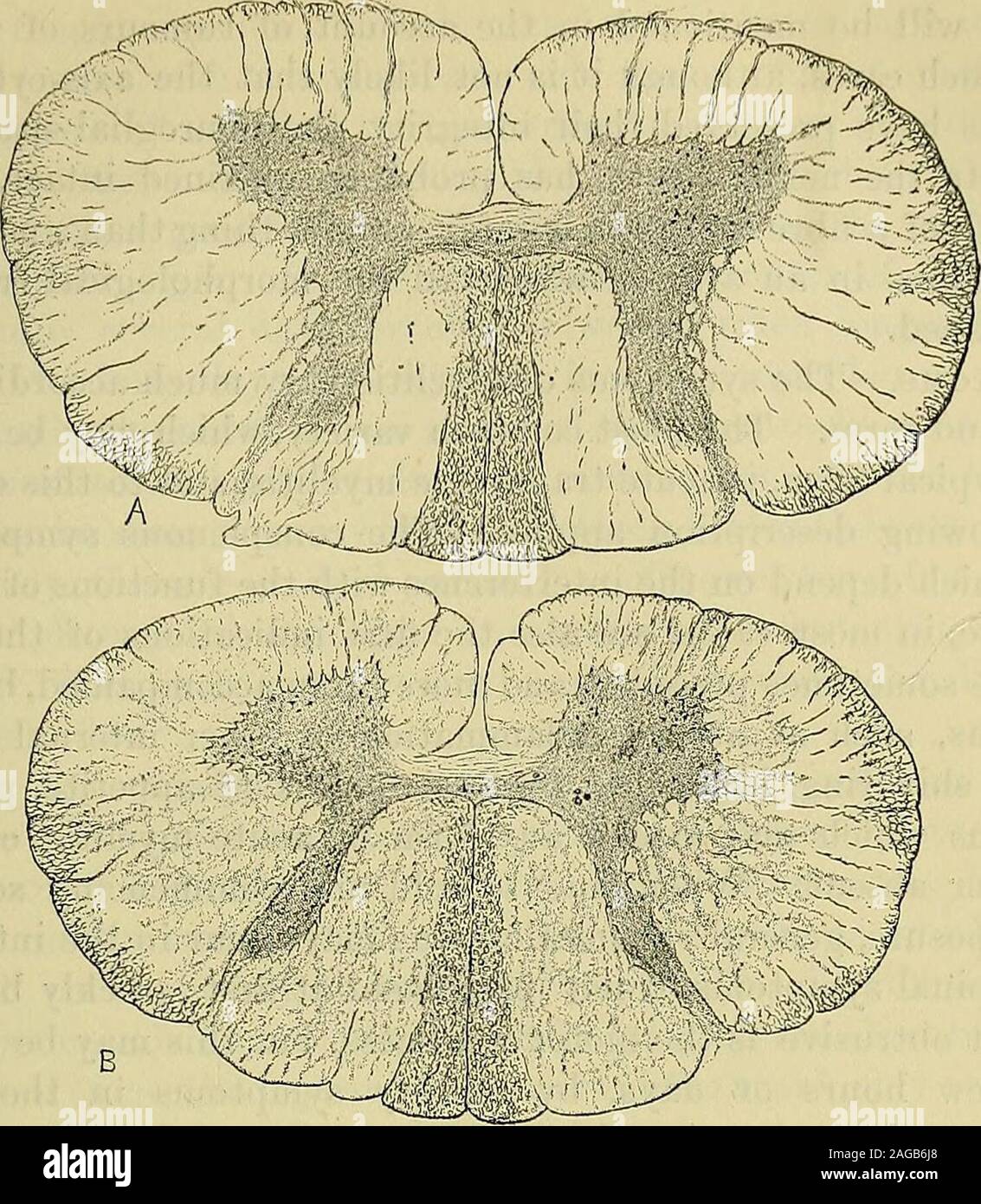 . A manual of diseases of the nervous system. fibres are smaller than anymet with in the normal cord. The appearance is as if there hadbeen an irregular ascending myelitis, which had extended up thecord as high as between the seventh and eighth cervical segments,and from the lower extremity of the normal fibres there had occurreda growth of new fibies such as effects the regeneration of nerves.*We seem to have here an actual process of renewal of fibres that hadbeen destroyed by such inflammation as has caused the empty spacesin the vicinity. If this is a correct interpretation of the appearan Stock Photo