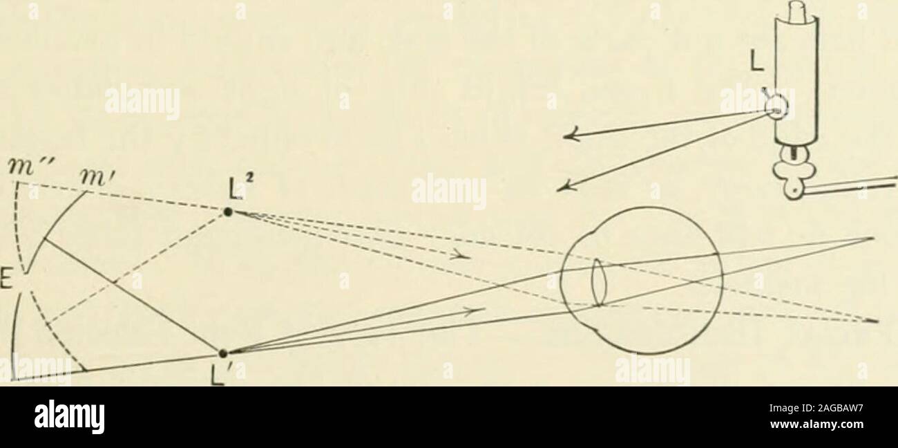 . Refraction and how to refract including sections on optics
