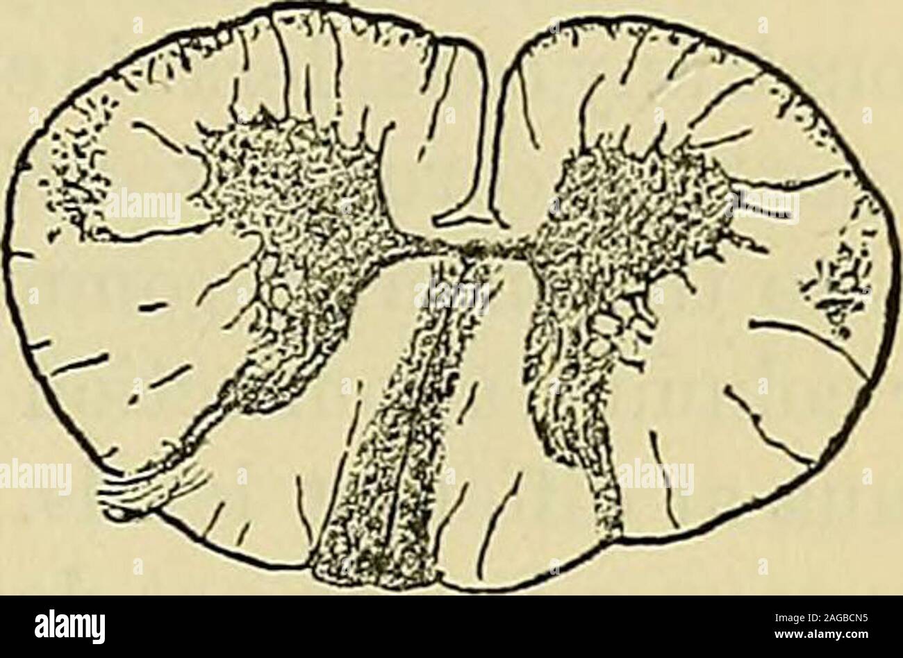 . A manual of diseases of the nervous system. stance,the two being separated by a lateral limiting layer of vertical fibres,in part broken up by processes from the grey matter. In the uppercervical cord, and also to a less extent in the dorsal cord, this layerextends forwards outside the anterior horn, which, in these parts, is * I].£f. by Minkowski, Deut. Arch. f. kl. Med., Bd. xxxiv, p. 433. Slight degene-ration of the pyramidal tracts was the only other lesion. f In the absence of evidence of contrary character, the direction in which fibresconduct must be assumed to be that in which they d Stock Photo