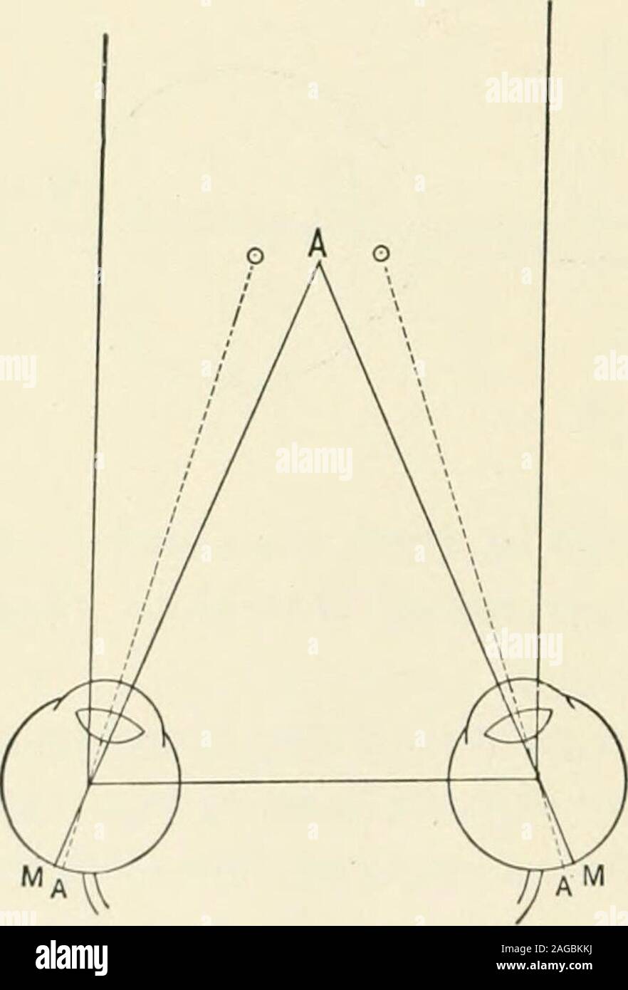 . Refraction and how to refract including sections on optics