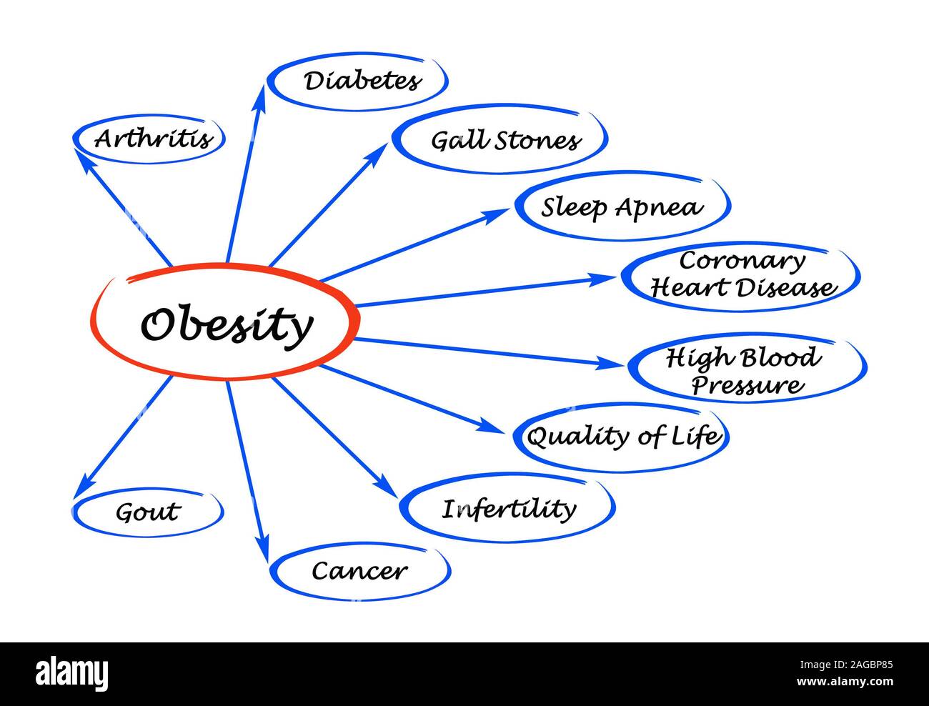 Diagram of Obesity Stock Photo - Alamy