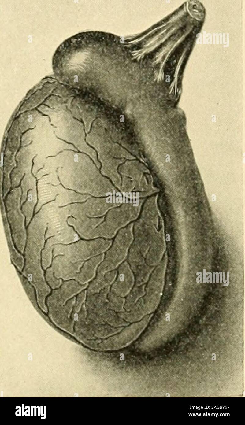 Tunica albuginea testis hires stock photography and images Alamy