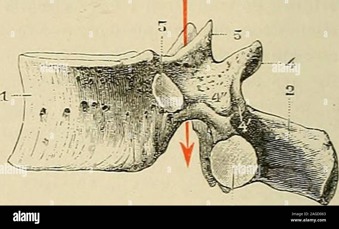 . Traité d'anatomie humaine : anatomie descriptive, histologie, développement. /.-? CM. Fig. 40. Onzième vertèbre dorsale, vue latérale. i. corps. — 2. apophyse épineuse. — 3. facette articu-laire pour la onzième côte. — 4, tubercule maïuillaire. —o, facette articulaire inférieure. — 6, .apophyse trans-verse. Fig. 41.Douzième vertèbre dorsale, vue latérale. f. corps. — 2. apophyse épineuse. — 3, facette articu-laire pour la tète de la douzième côte. — 4. apophysetransverse. — 5. apophyse articulaire supérieure. —6, apophyse articulaire inférieure. même valeur que les deux tubercules mamillaire Stock Photo