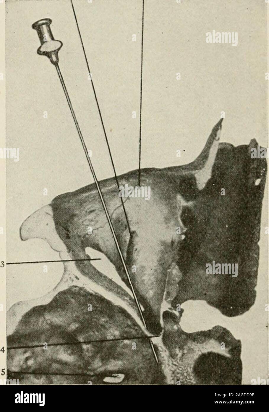 Orbital injection hires stock photography and images Alamy