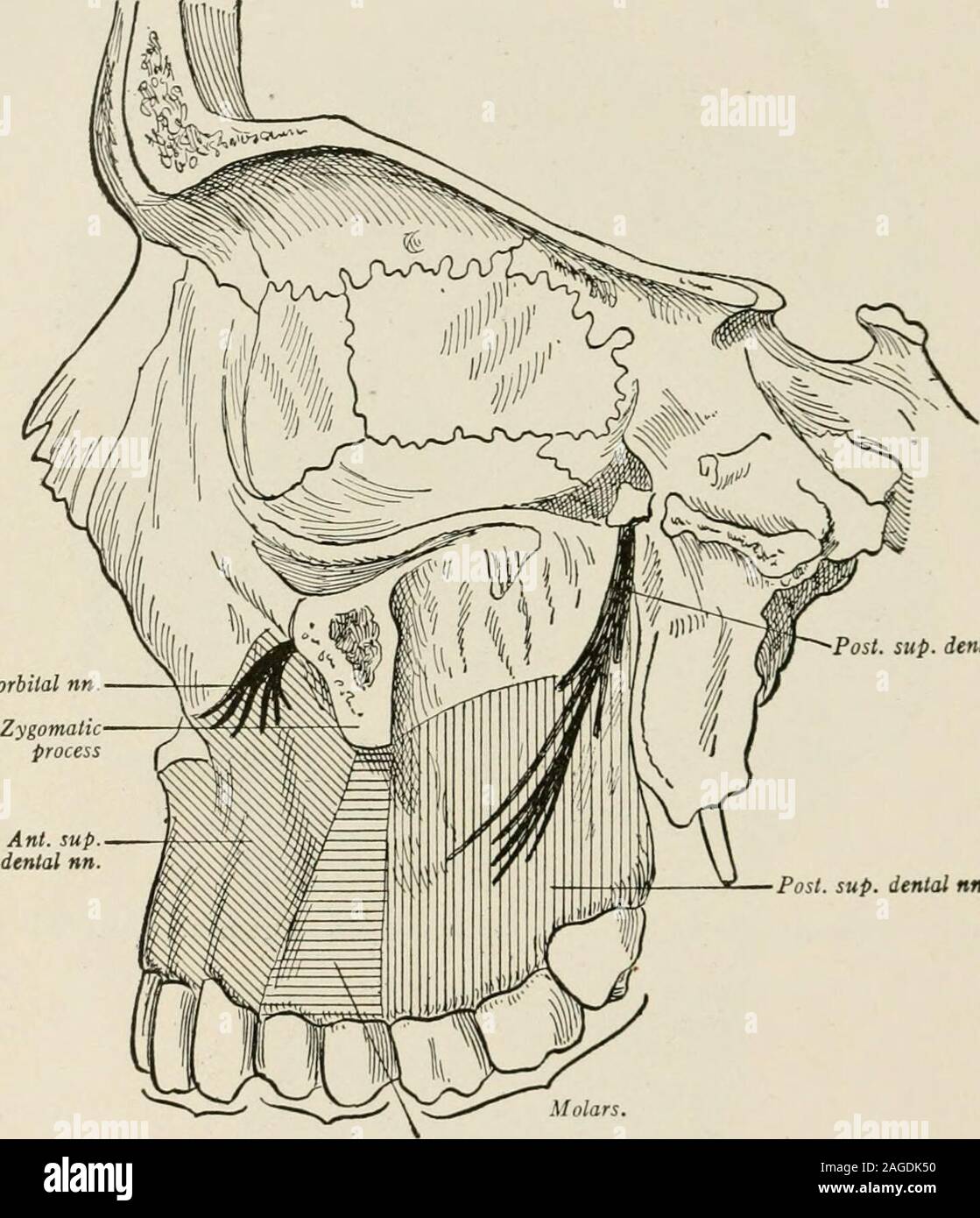 . Local and regional anesthesia; with chapters on spinal, epidural, paravertebral, and parasacral analgesia, and other applications of local and regional anesthesia to the surgery of the eye, ear, nose and throat, and to dental practice. Fig. 163.—Regional anesthesia by way of infra-orbital foramen. (After Fischer.) r^ i 1 I: Li- Fig. 164.— Resulting area of anesthesia after bin kint; both infra-orbital nerves at infra-foramen. (Braun.) of the fifth nerve are involved in the field of operation it is alwayspreferable to block the gasserian ganglion when possible, but for 534 LOCAL ANESTHESL^ va Stock Photo