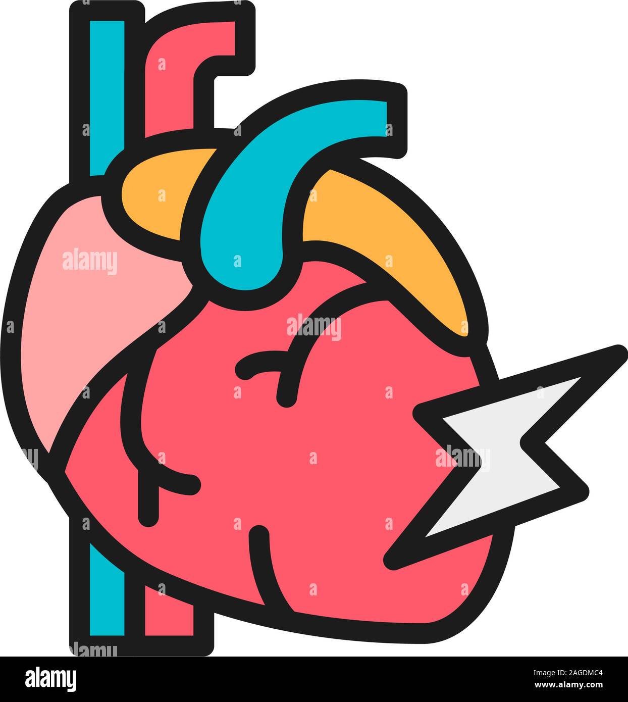 Myocardial Infarction High Resolution Stock Photography