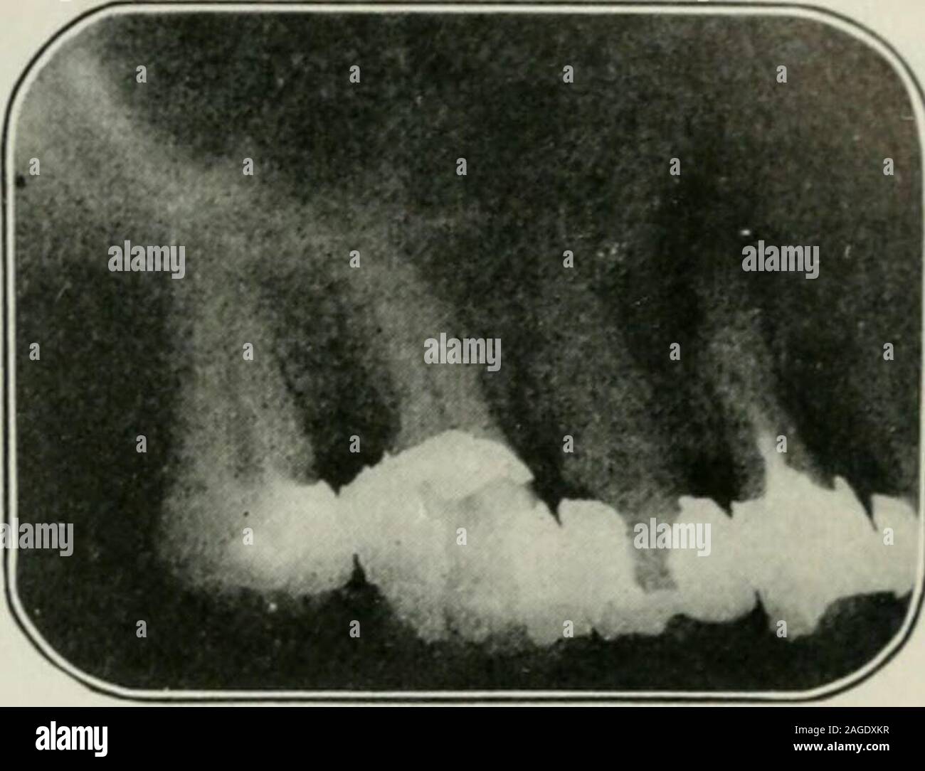 Tom Audreath Smøre Accor An elementary book on electricity and magnetism and their applications.  Fig. 431. — Radiographic apparatus arranged for use in a dental  hospital.(Photographic film inside patients mouth.) ROENTGEN RAYS AND OTHER  RAYS