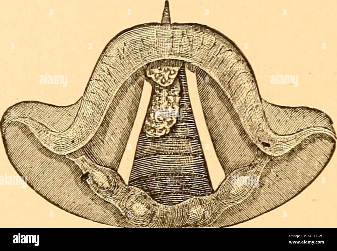 . A manual of diseases of the nose and throat. w, and sodilate the