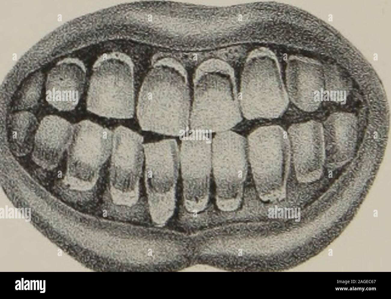 Pathological Tooth . The anatomy, physiology and pathology of the human teeth : with the ...