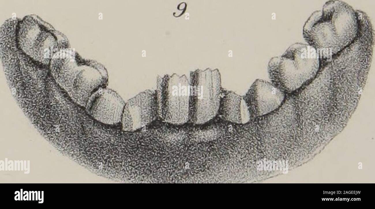 Pathological Tooth . The anatomy, physiology and pathology of the human teeth : with the ...