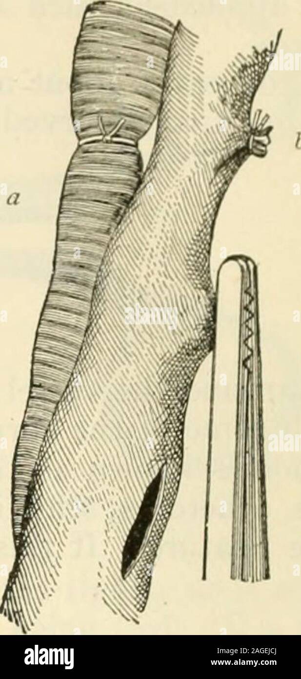 . Modern surgery, general and operative. Fig. 239.—Hagedorns needles ...
