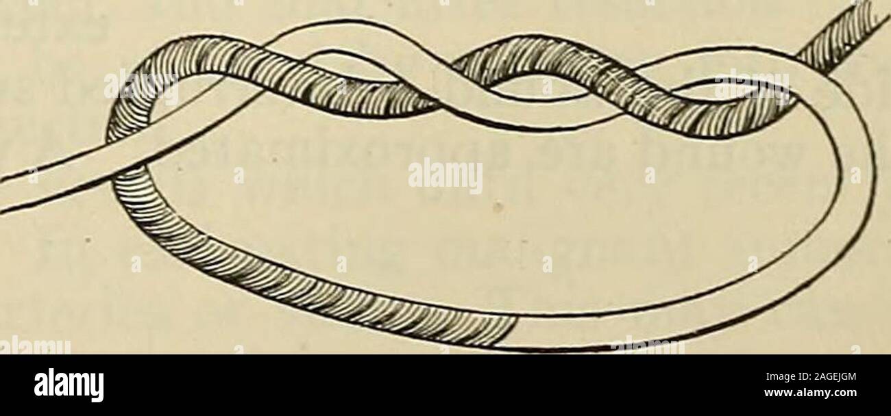 . Modern surgery, general and operative. Fig. 236.—Method of tying