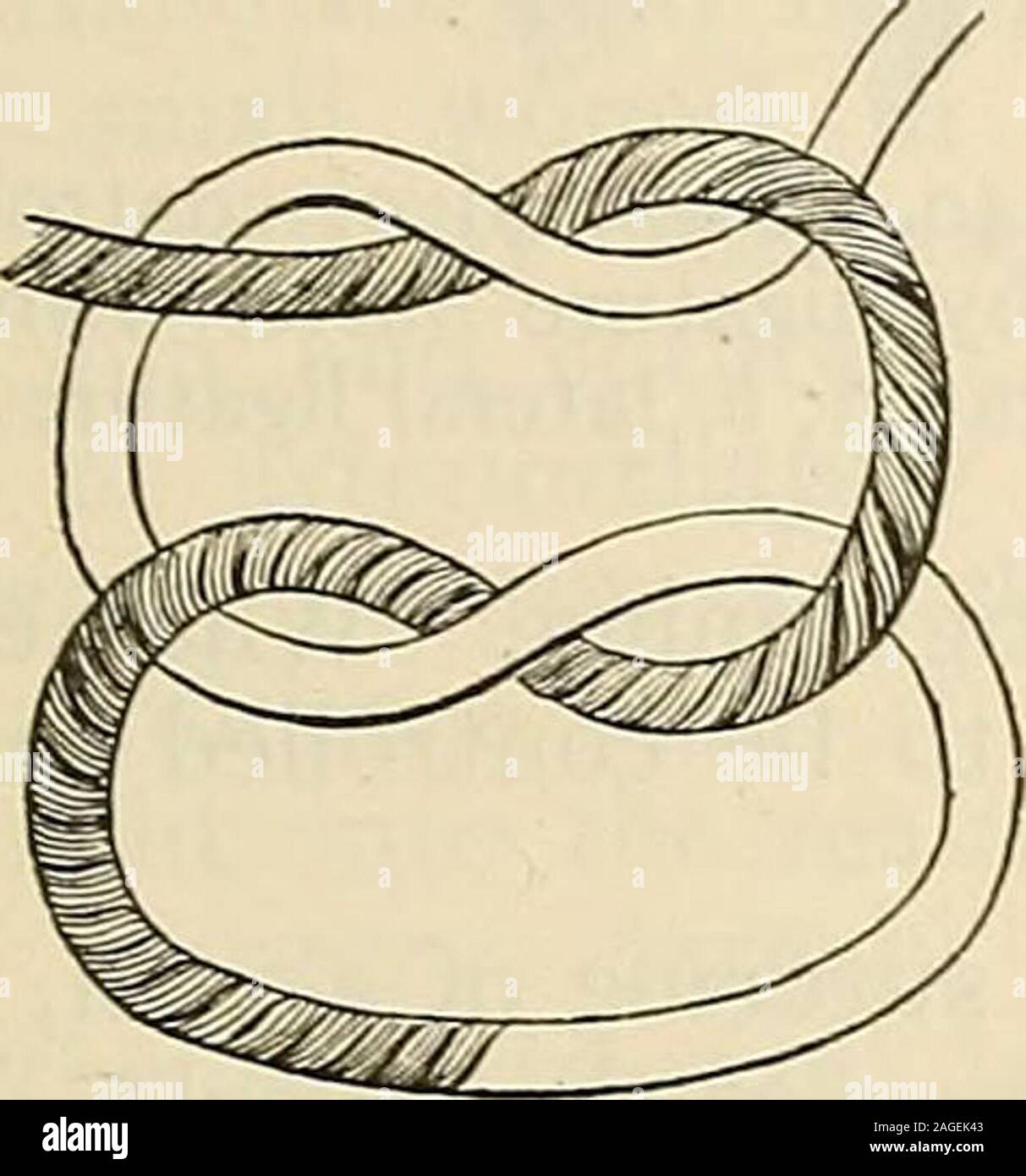 . Modern surgery, general and operative. Fig. 235.—Tenaculum. the