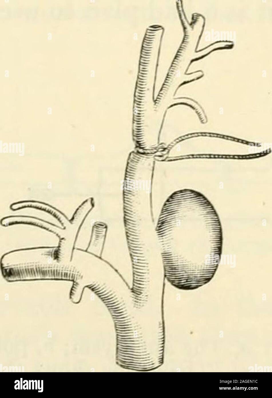  Modern Surgery General And Operative Ient Returned To His Workas A 