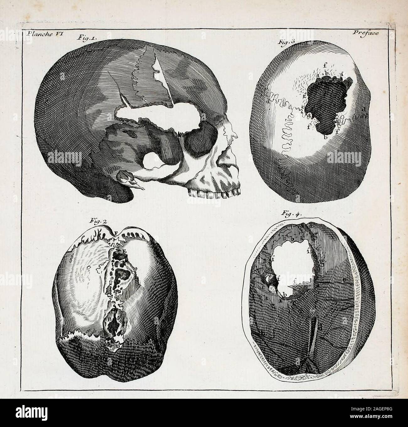 Osteo Graphie Ou Description Des Os De L Adulte Du Foetus C Precedee D Une Introduction