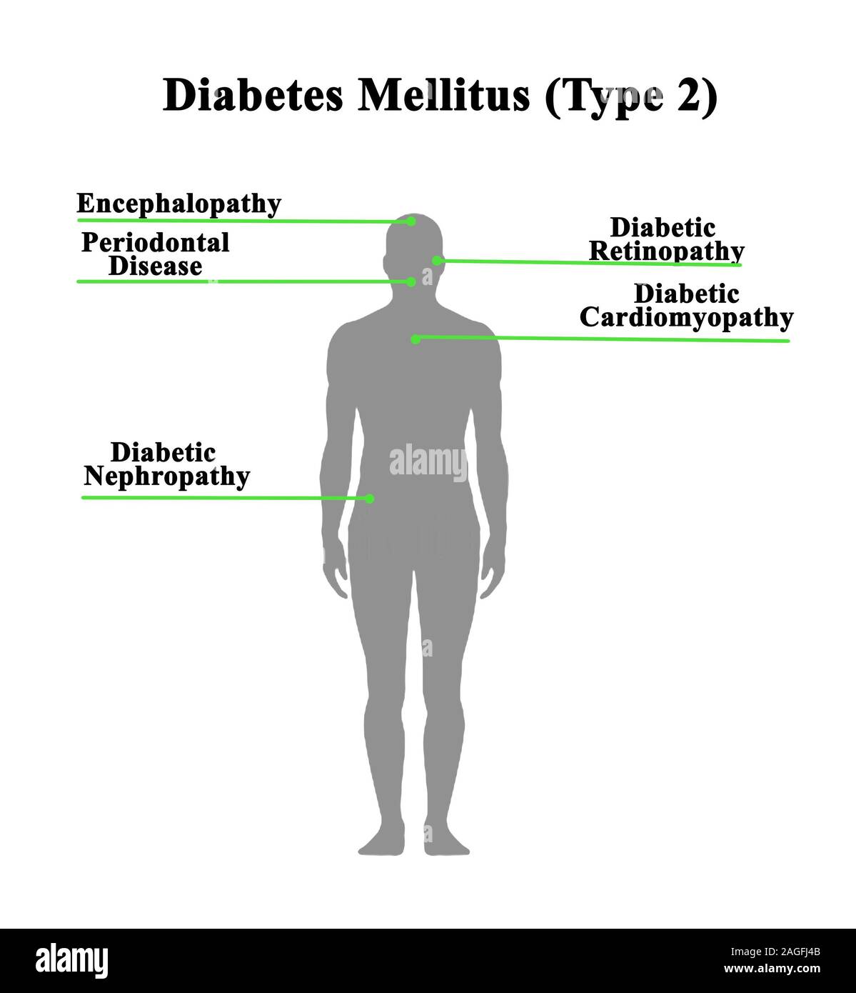 Diabetes type 2 Cut Out Stock Images & Pictures Alamy