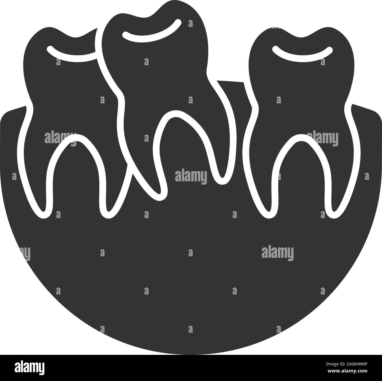 Crooked teeth glyph icon. Malocclusion. Wisdom tooth problem. Silhouette symbol. Negative space. Vector isolated illustration Stock Vector