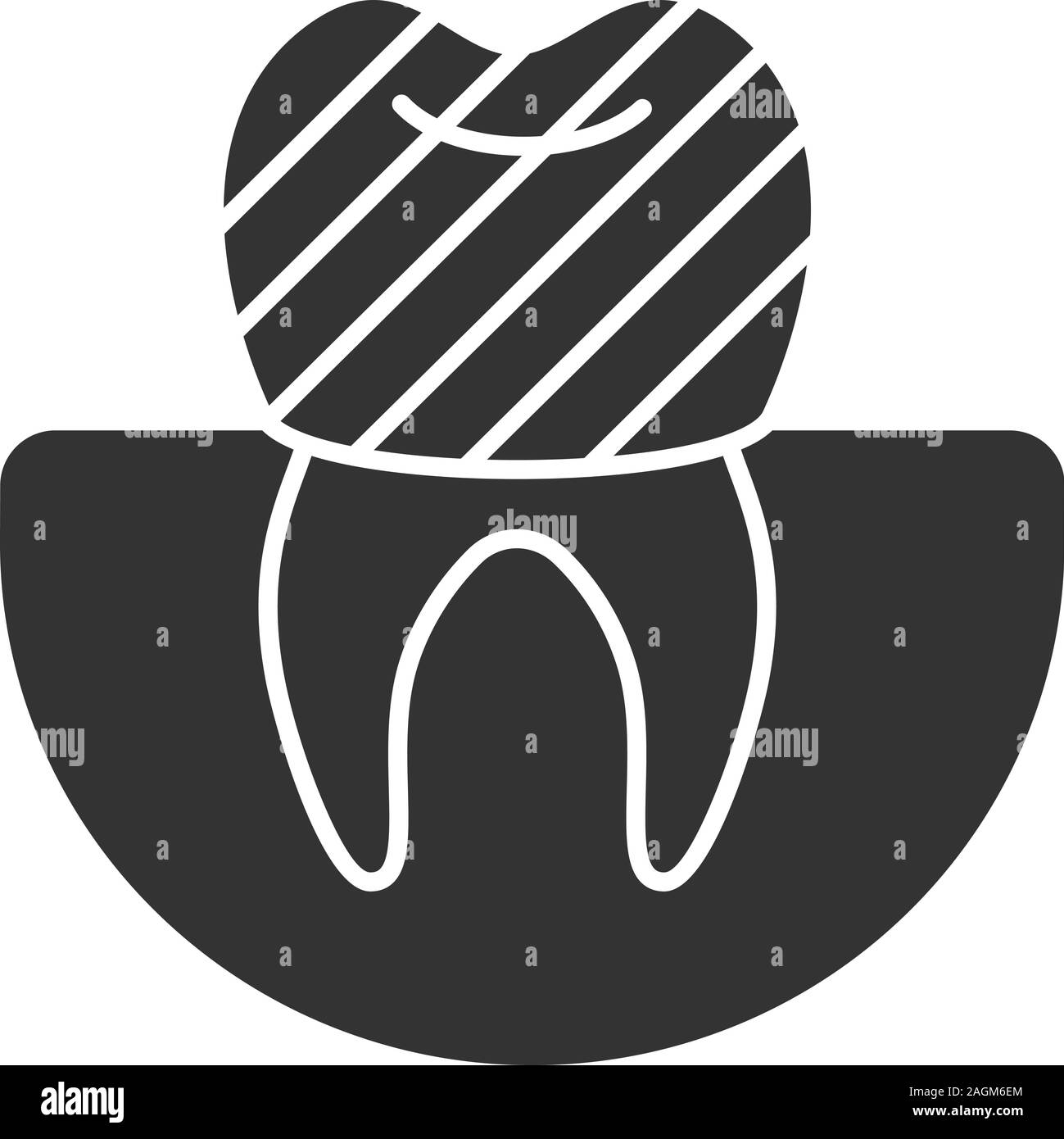 Dental crown glyph icon. Tooth restoration. Silhouette symbol. Negative space. Vector isolated illustration Stock Vector