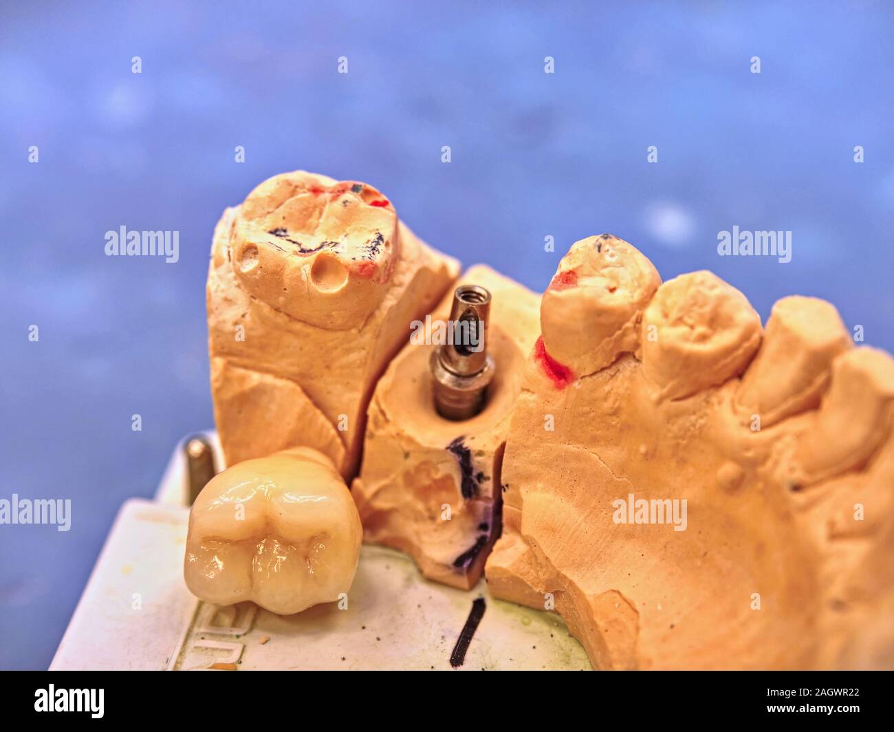 Technical shots on a dental laboratory. Dentist work on a dental