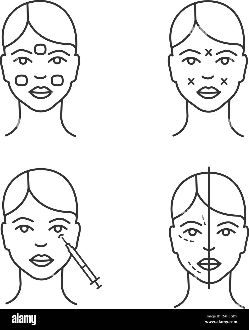 Botox injection linear icons set. Anesthetic cream, before and after, crows feet botox injection, sites. Thin line contour symbols. Isolated vector ou Stock Vector