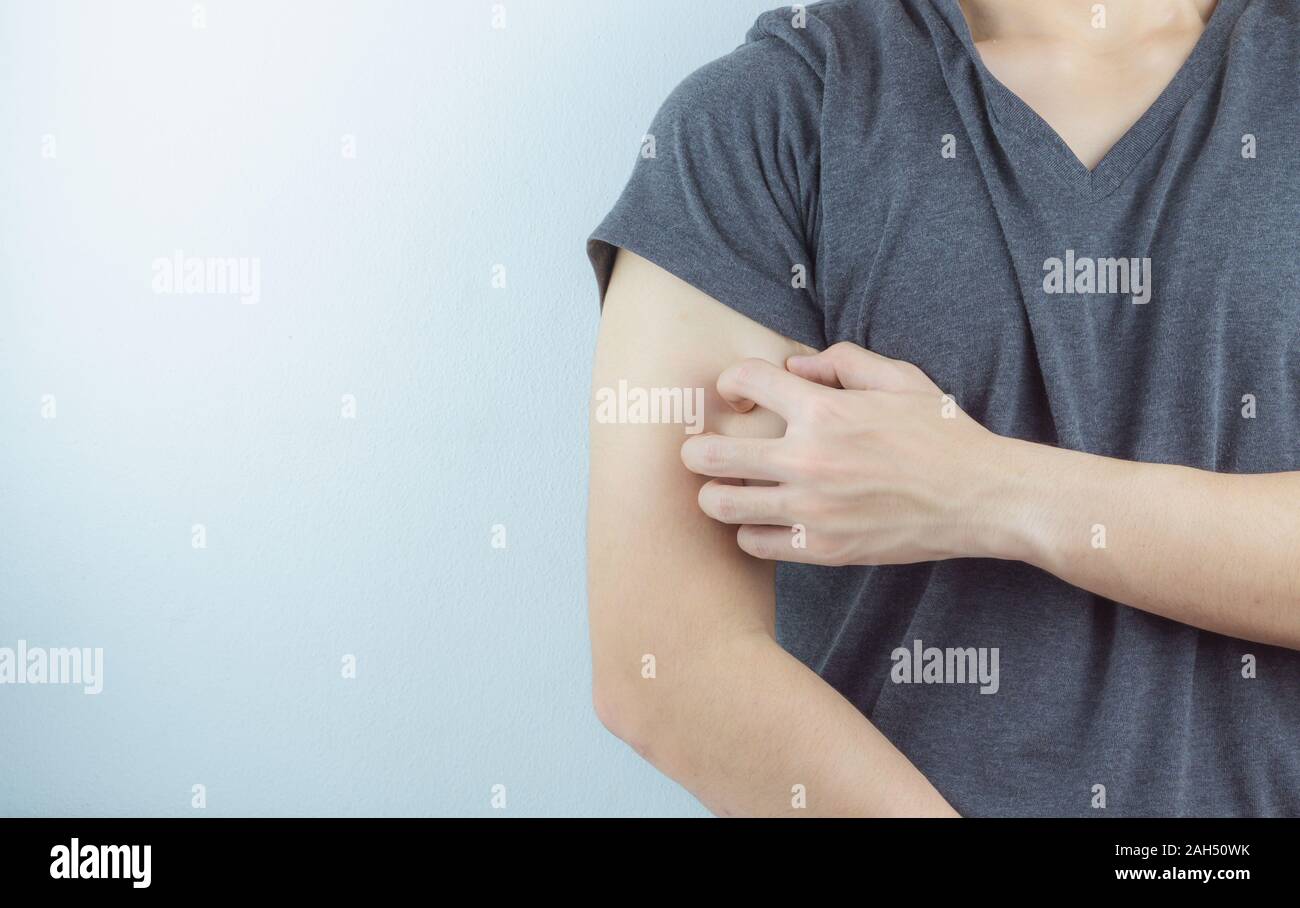 Close up man scratching his itchy arm with allergy rash by hand on