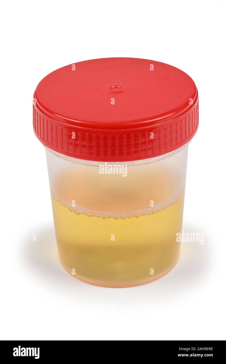 Urine sample in container. High resolution photo. With clipping path