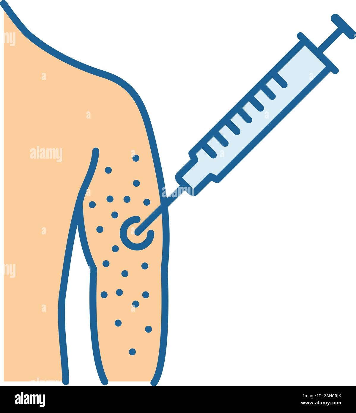 Vaccine allergy color icon. Vaccination injection. Syringe in arm. Drug injecting. Skin rash, irritation. Isolated vector illustration Stock Vector