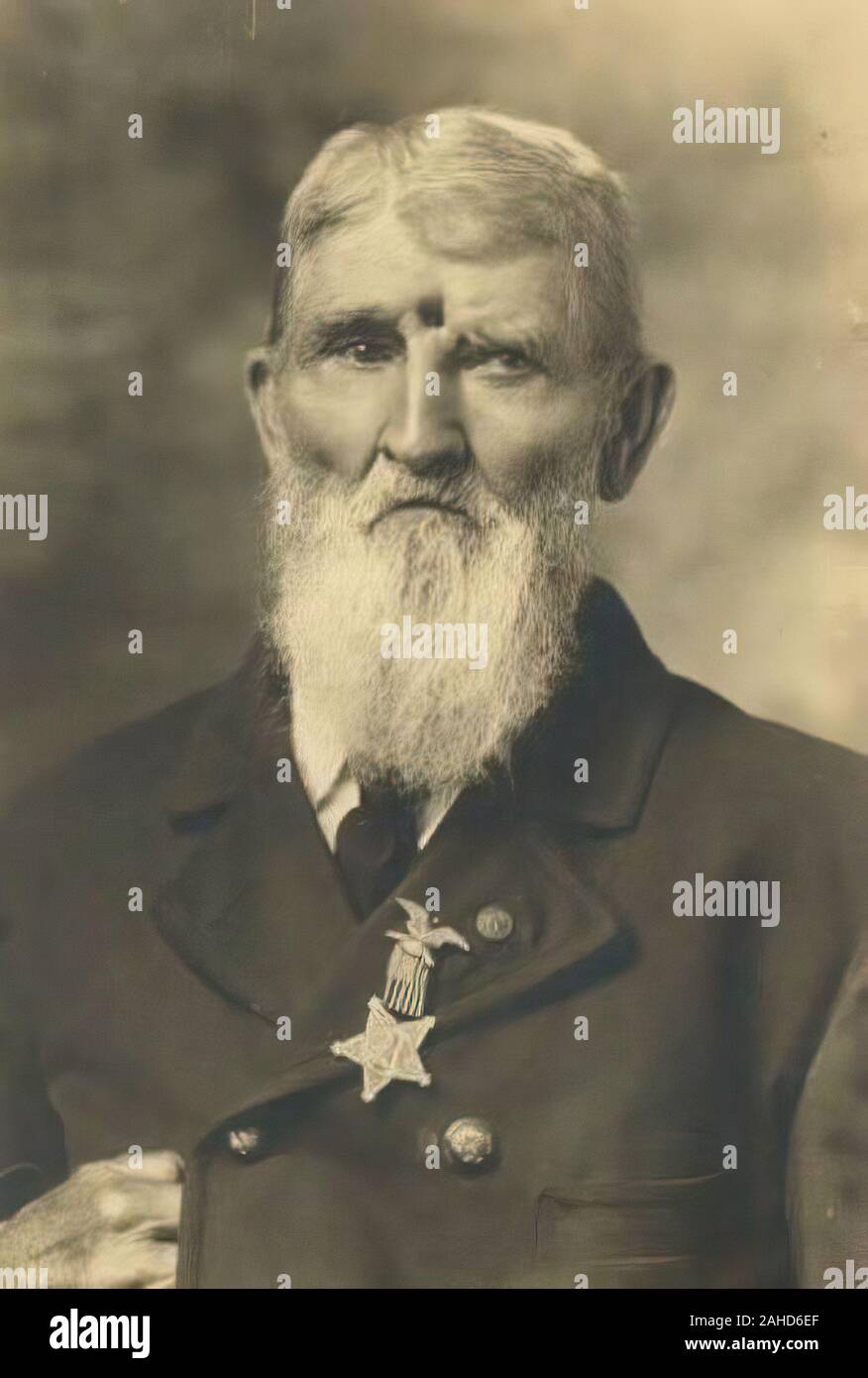 Civil War veteran Jacob Miller lived with an open gunshot wound to the forehead. He was quoted as saying Ò17 years after I was wounded, a buckshot fell out of my wound, and 31 years after two pieces of lead fell outÓ. Photo/Quote circa 1899. Stock Photo