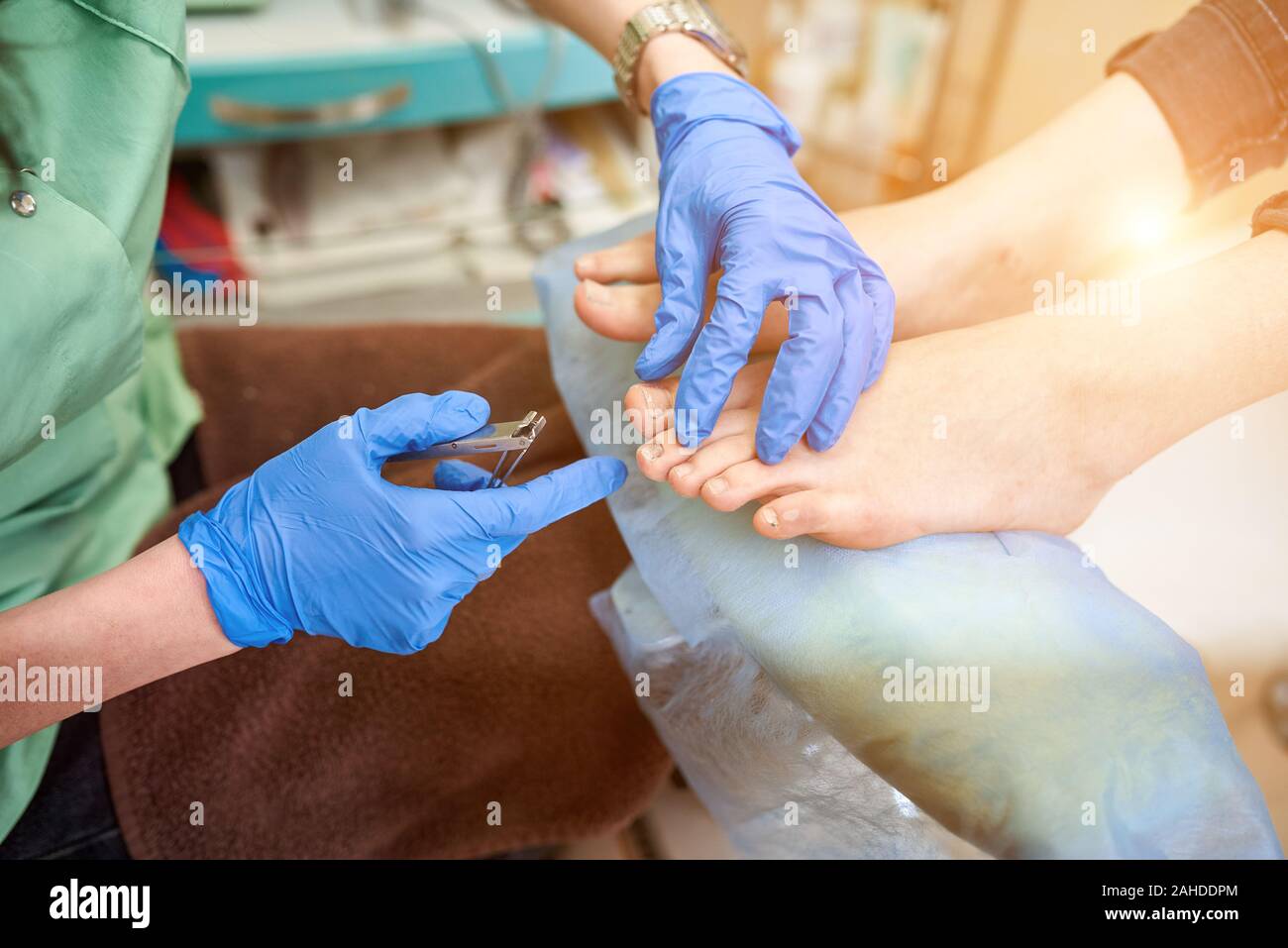 Close up. Patient on medical procedure, visiting podiatrist. Foot