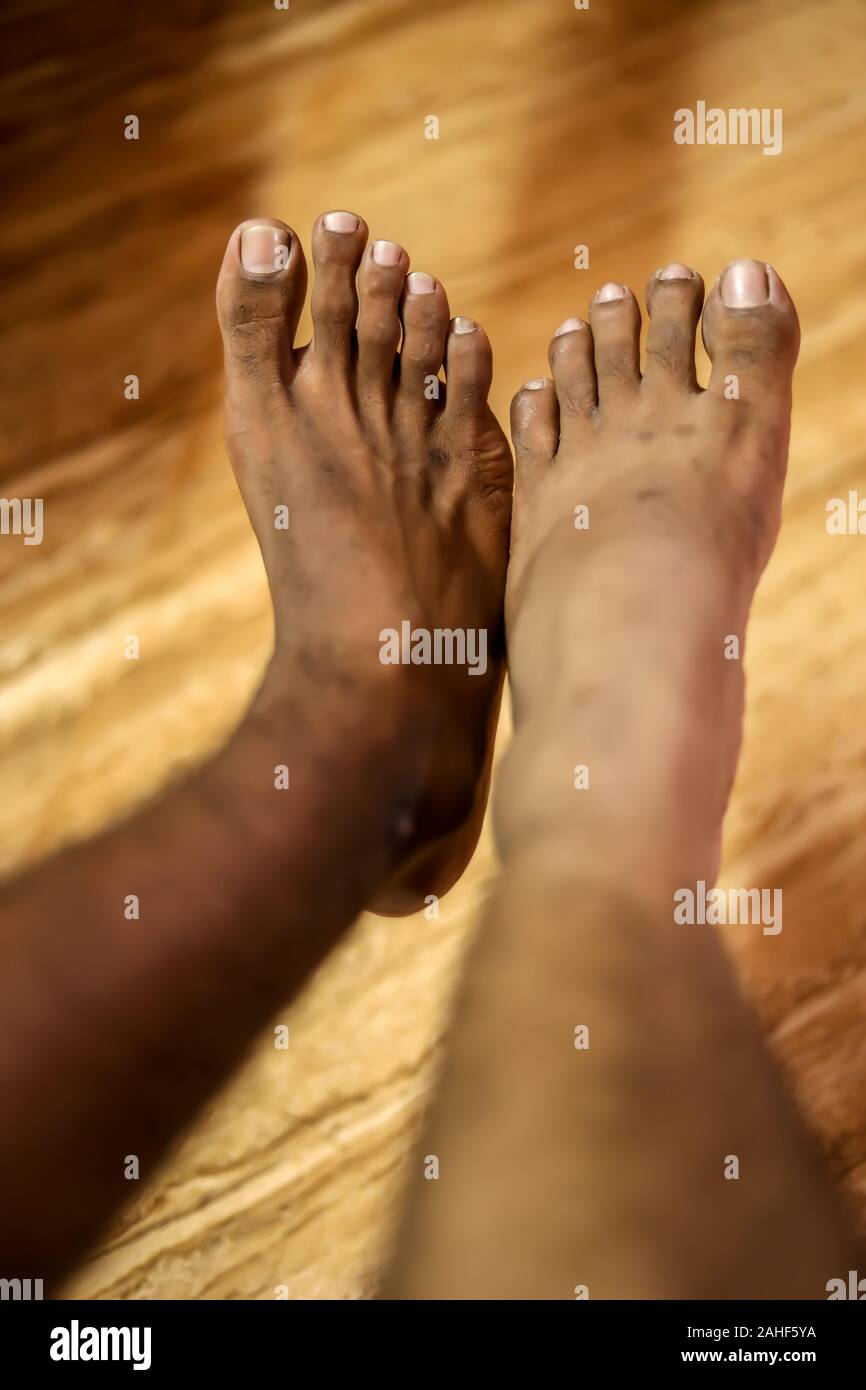 Cropped close-up view image concept photo of two different leg Stock Photo