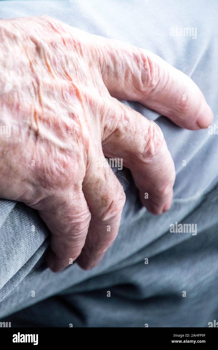 A close up of an elderly person's hand resting on their leg Stock Photo