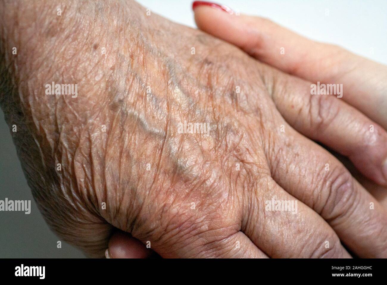 The process of aging of human skin wrinkled hands of a very old man