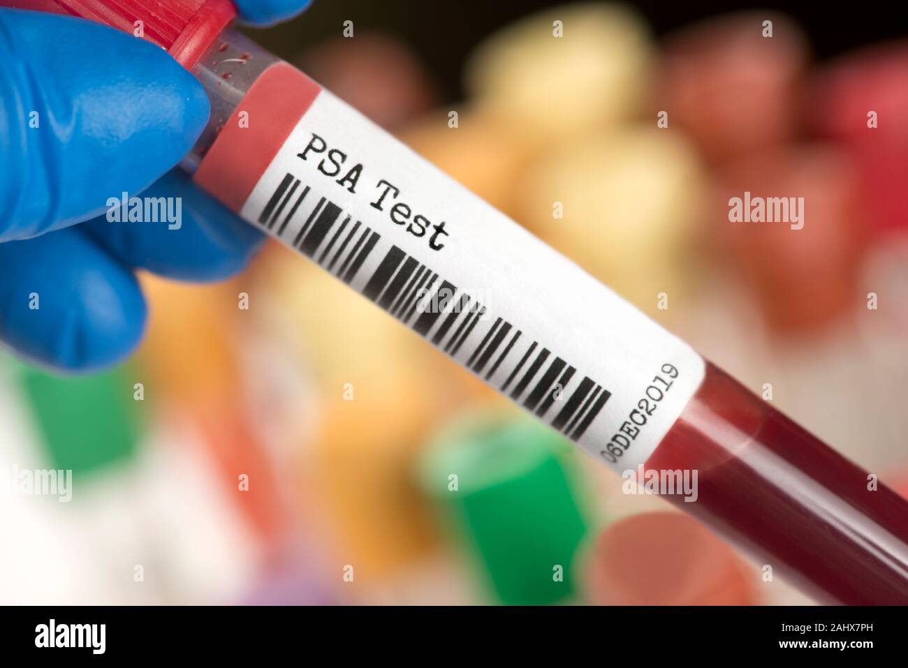 PSA-Prostate specific antigen blood test tube. A PSA test is used to determine the presence of the glycoprotein produced by the prostate ducts as a ma Stock Photo
