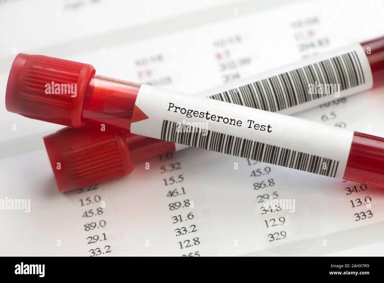 Progesterone Blood Test Tubes On Labaoratory Report A Progesterone Blood Test Can Provide Information About Infertility Ovulation And Placental Fu Stock Photo Alamy