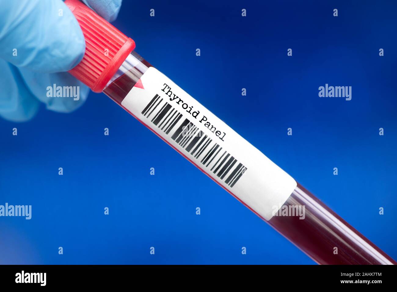Thyroid panel blood test tube. A thyroid panel is a group of tests that may be helpful in  evaluating thyroid gland function and to diagnose thyroid d Stock Photo