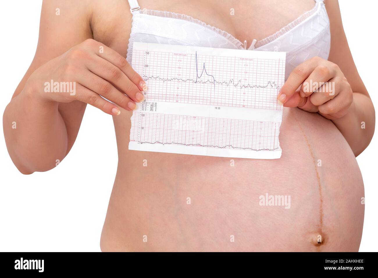 Pregnant woman holding ctg graph in hand on white background. Waiting baby concept. Stock Photo