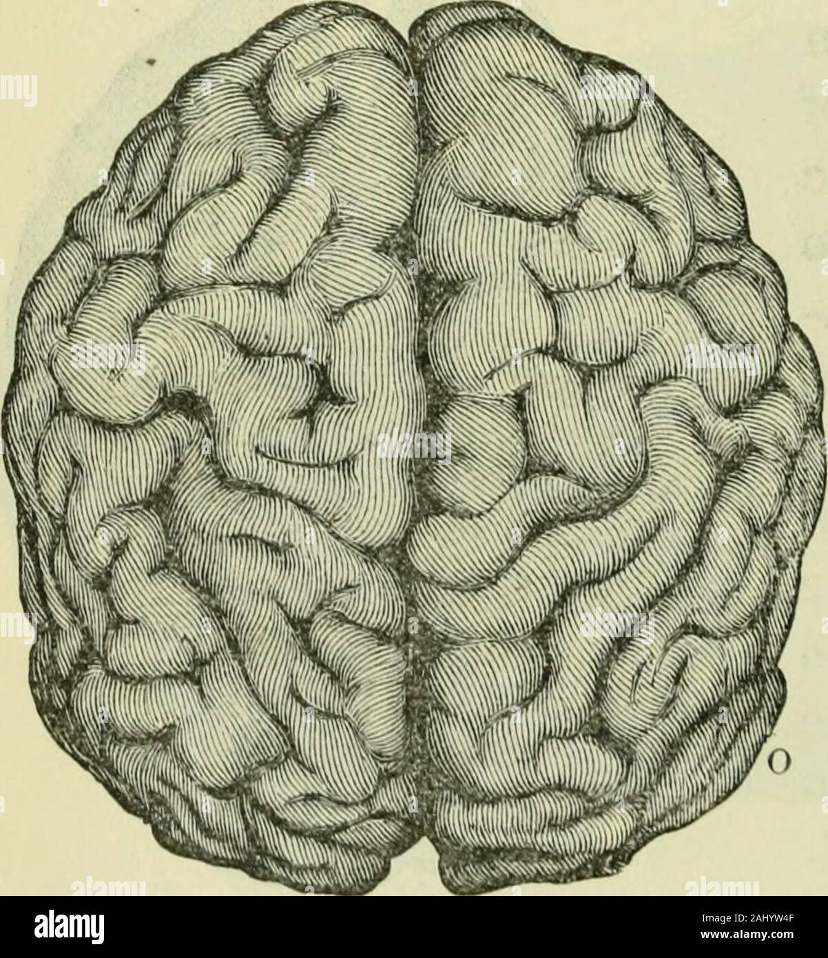 The brain as an organ of mind . ar Fissure is sometimes muchshorter and less obvious (fig. 119) than it is in either ofthe other two great Apes, so that in this respect its brainapproaches more closely to that of Man. It is sometimes interrupted above byan upperconvolutionhas a superficial posi-tion of this kind inno other of the Quad-rtimana, excei:)t inAteles. According to Ptolle-ston this superficialposition of the upperor first bridging con-volution is not con-stant in the Orang or Fig. 119.—Brain of Orang, upper aspect. (Duncan, eVCU in Man while in both it may attimes be present onone si Stock Photo