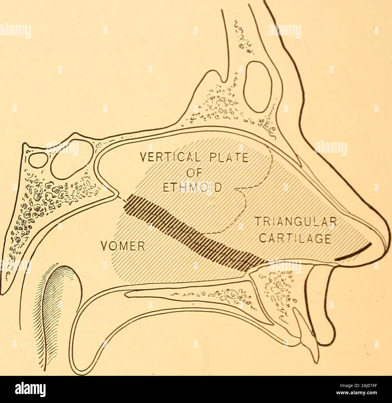 A Manual Of Diseases Of The Nose And Throat Overthe Cartilage