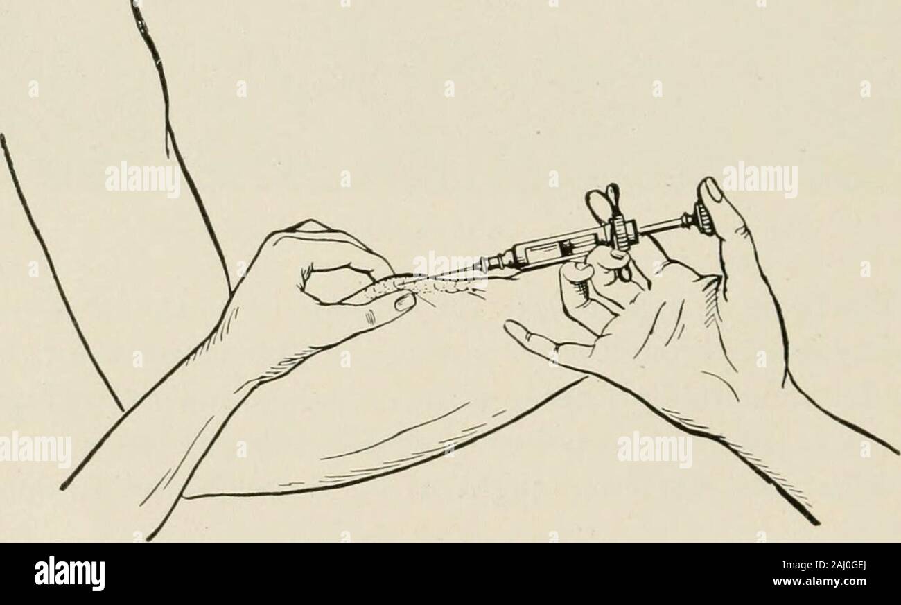 Local and regional anesthesia; with chapters on spinal, epidural