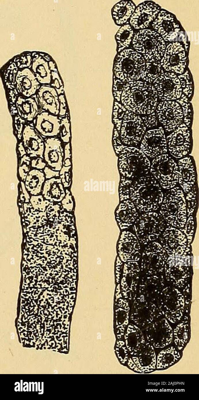 Diagnostic methods, chemical, bacteriological and microscopical : a text-book for students and practitioners . as the coarse granules are undoubtedly derived from the renal epithelium,which has degenerated completely. The coarser the granules the more severethe inflammatory process. These granular casts vary in shape and in size, but are usually shorterthan the hyaline type. To these granular casts may be attached various cellsso that it is difficult to tell whether the cast is really a true granular or a cellularone. In some cases these cellular inclusions mayundergo fatty degeneration giving Stock Photo