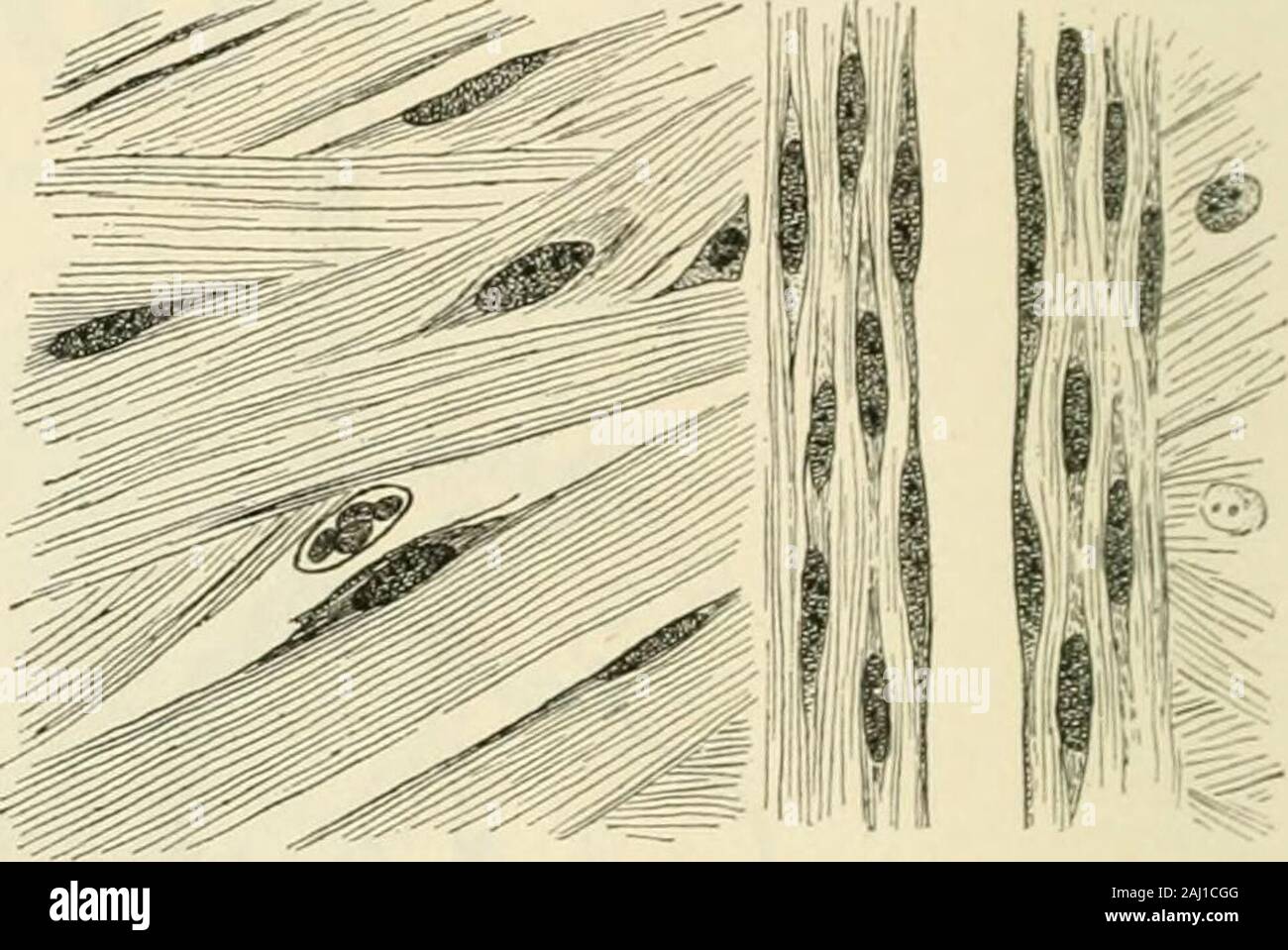 Modern Surgery General And Operative Fig 65 Blood Vessels In Granulation Gross Fig 66 Cicatricial Tissue X 670 Fowler Wound Contracts Thus The Wound Margins Are Pulled And Held Nearertogether The Gap To Be Bridged