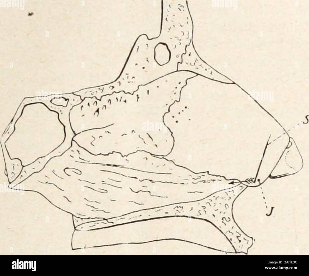 Interstate medical journal . (As shown in Fig. 1.) Both Hajeckand Killians incisions are curved, beginning at the floor of the nose andextending forward and upward. The incision of Killian is L-shaped.making a flap of the muco-perichondrium, which is pushed up out ofthe way, giving a clear open view of the posterior part oi the septum.Both these incisions have their advantages and disadvantages. In boththe Killian and Hajeck incisions there remains a pocket between the twomuco-perichondrial surface after the cartilage and bone have beentinoved. The chances for infection are much greater, owing Stock Photo