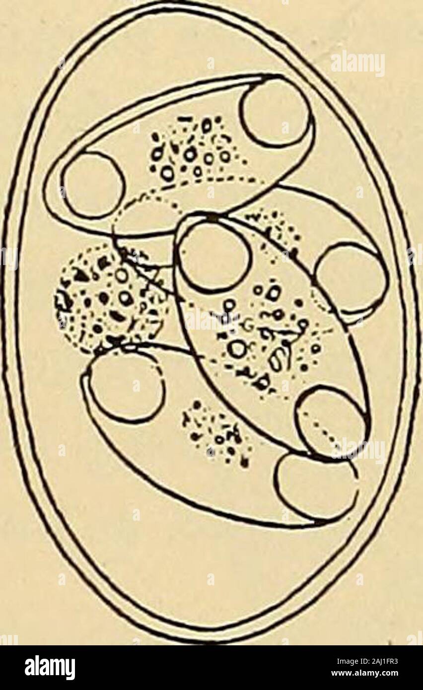Diagnostic methods, chemical, bacteriological and microscopical : a text-book for students and practitioners . Fig. 25.—Coccidium hominis, from intestine of rabbit: i, A degenerate epithelial cellcontaining two coccidia; 2, free coccidium from intestinal contents; 3, coccidium with fourspores and residual substance; 4, an isolated spore; 5, spore showing the two falciformbodies— X 1140. {Tyson after Railliet.) (b). Sporozoa.Coccidiimi Hominis (coccidimn perforans; cystospermiimi hominis). This organism appears in the feces as an oval or spherical parasite about22 microns long and showing a thi Stock Photo