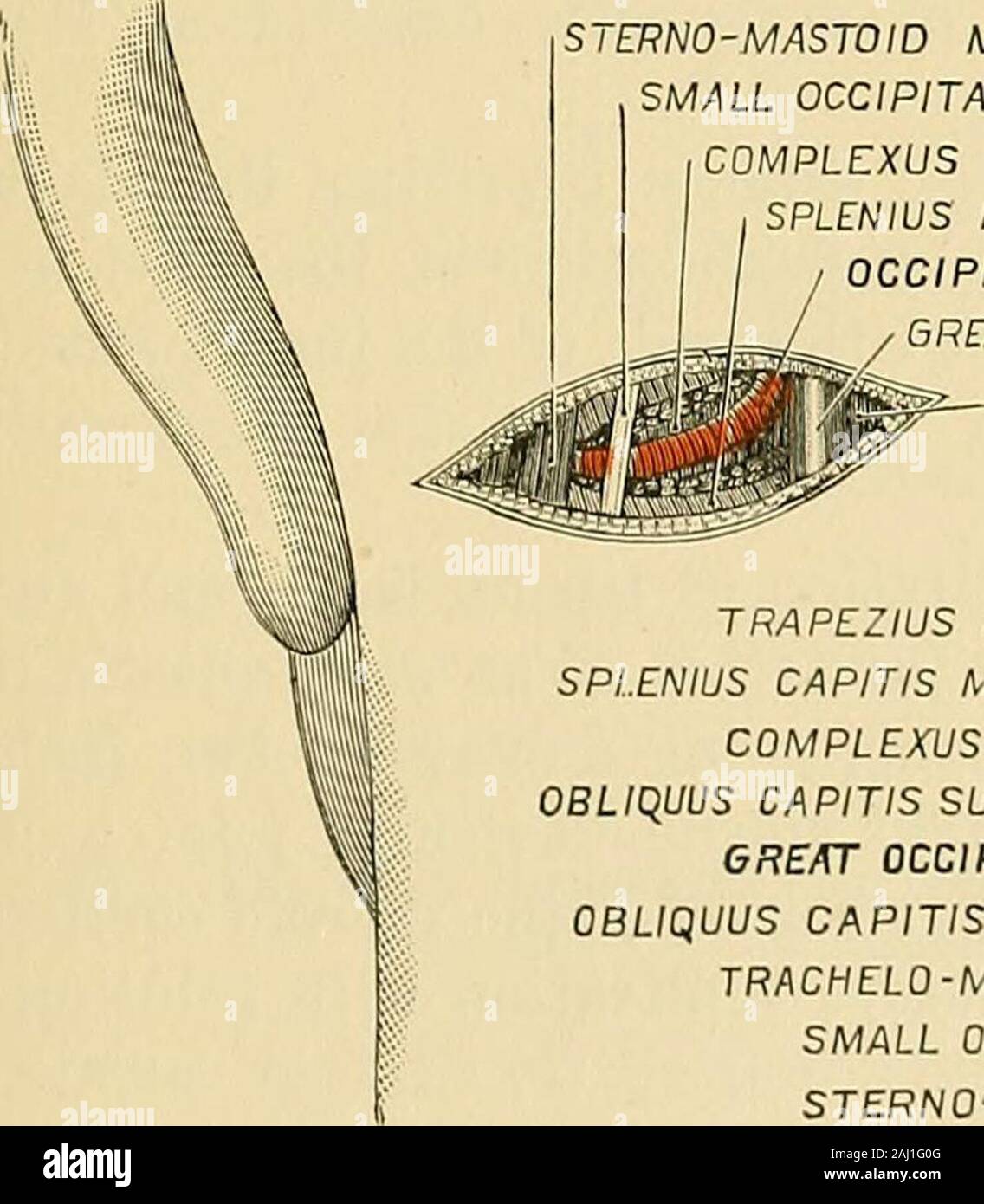 Operative surgery . elt. About two inches above thezygomatic process it divides into its
